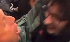 Tifozi i famshëm i Unitedit që u bë viral me flokët e tij, sulmohet pas ndeshjes me Chelsean – Ekonomia Online