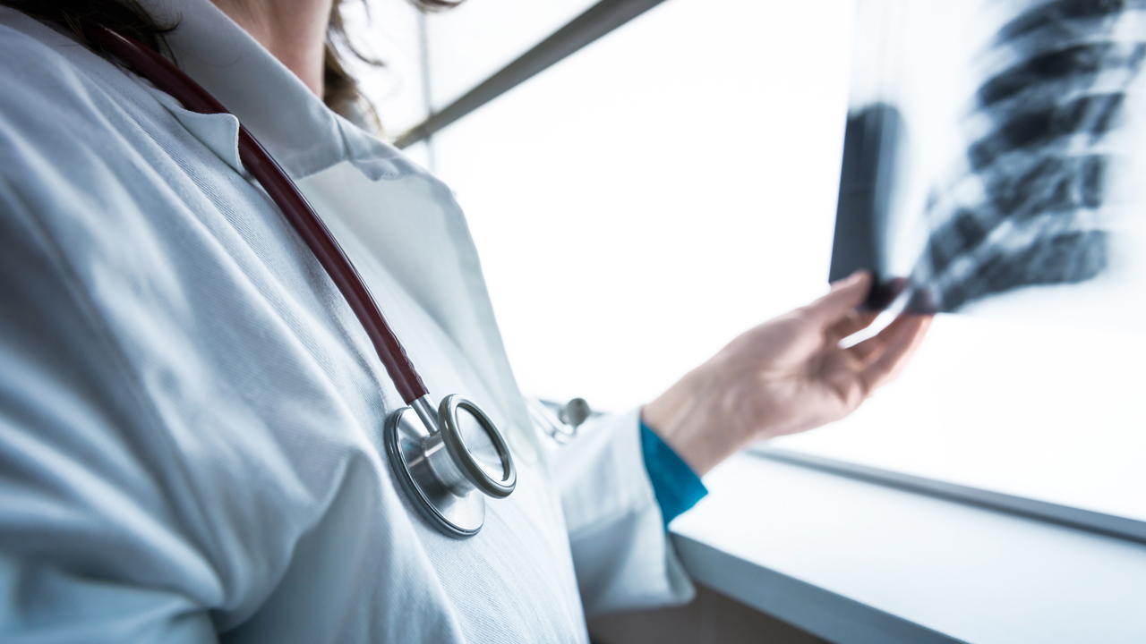 13 shenja se mund të keni kancer të mushkërive – Ekonomia Online