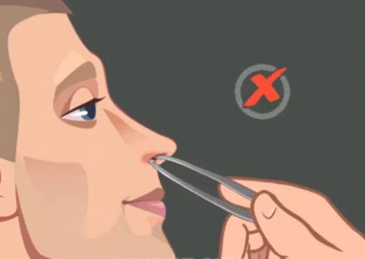 Shkulja e qimeve të hundës mund të jetë vdekjeprurëse – Ekonomia Online