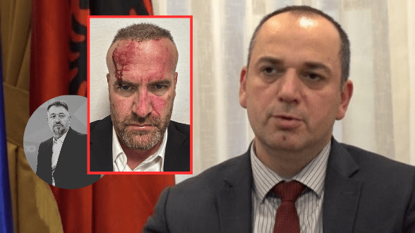 “Akt qyqar, kur s’kanë argumente, përdorin grushtet” – Haskuka reagon ashpër pas sulmit ndaj Mehanit